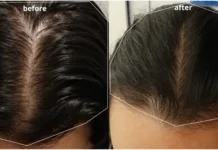 How do I grow hair thicker? Which vitamins can I take?